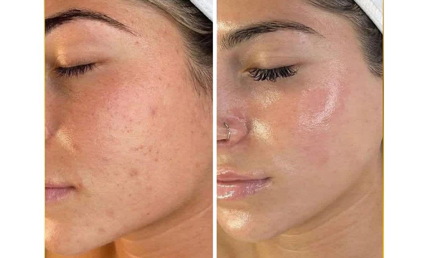 Image 3: Collagen Facials & Upper-Body Massages for Rejuvenation & Relaxation