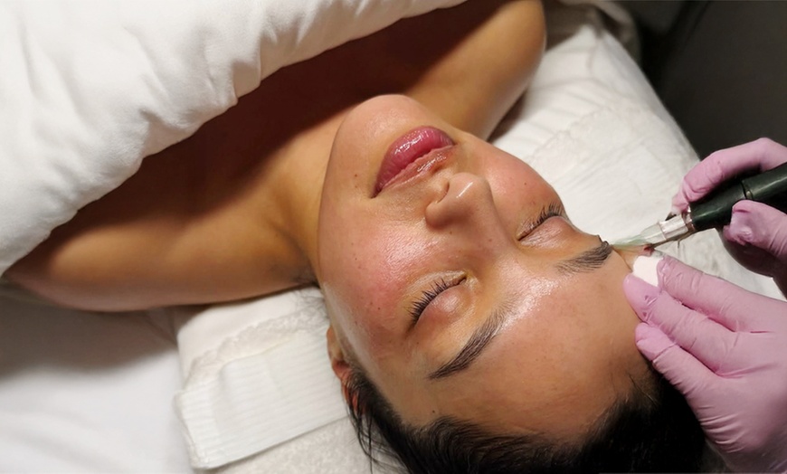 Image 4: Refresh Your Skin with One or Two Hydra Facials or VI Peels