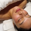 Image 4: Refresh Your Skin with One or Two Hydra Facials or VI Peels