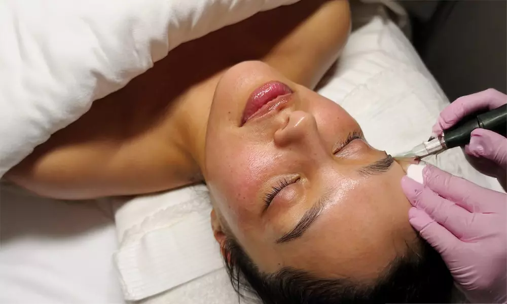 Refresh Your Skin with One or Two Hydra Facials or VI Peels
