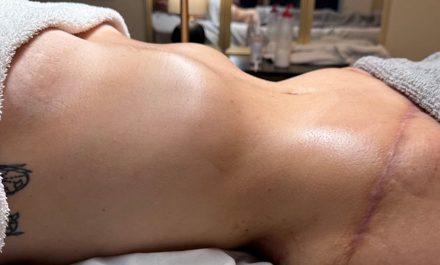Image 2: Lymphatic Drainage for Revitalization, Sculpting & Fluid Balance