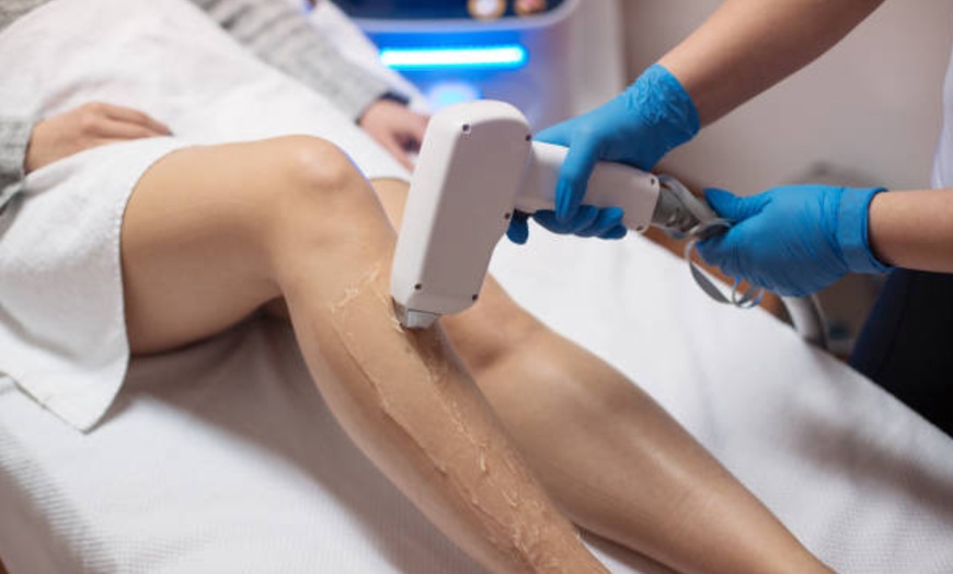 Image 10: 1, 3 o 6 sesiones de depilación con láser de diodo en zona a elegir