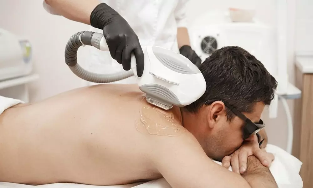 Six IPL Laser Hair Removal Sessions for Multiple Treatment Areas