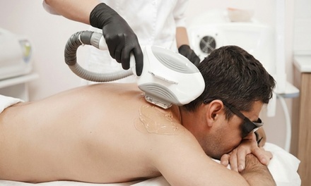 Six IPL Laser Hair-Removal Sessions on One Extra-Small Area - Alluring Look Skin And Laser Artistry
