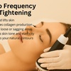 Image 1: Glow with One, Two or Three 60 Minute Radio Frequency Skin Tightening 
