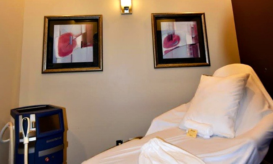 Image 2: Six Laser Hair Removal Sessions for Small, Medium, or Large Area