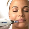 Image 1: 1, 2 o 3 sesiones de microneedling facial de vitaminas con Dermapen
