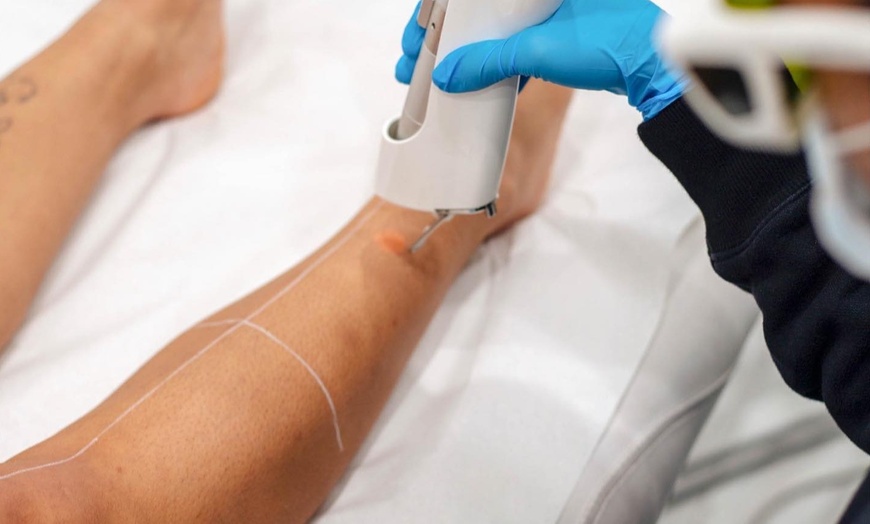 Image 5: Get Smooth Skin w/ 4 or 6 LHR Session for Small, Medium, or Large Area