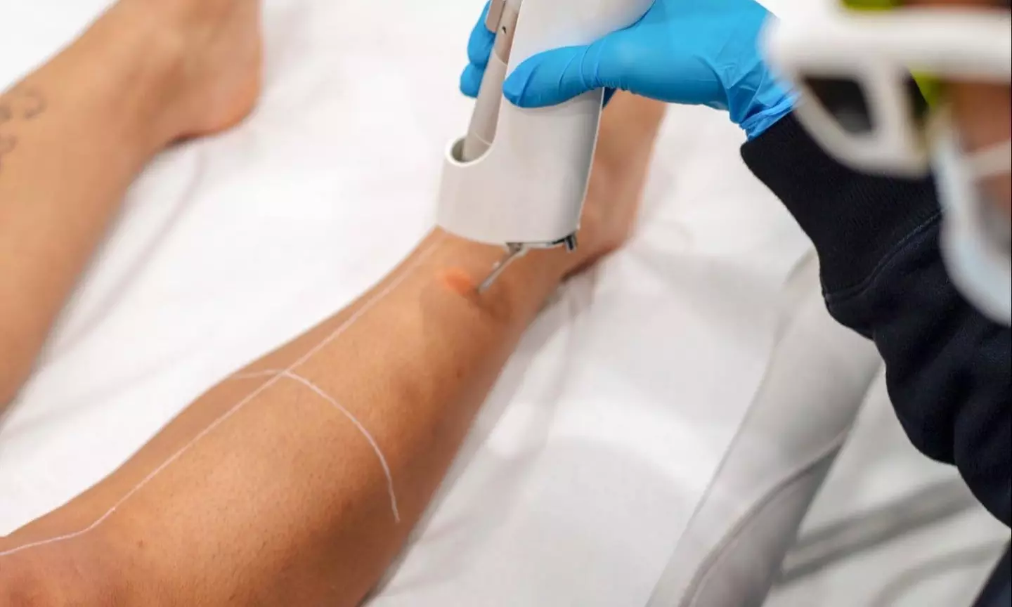 Get Smooth Skin w/ 4 or 6 LHR Session for Small, Medium, or Large Area