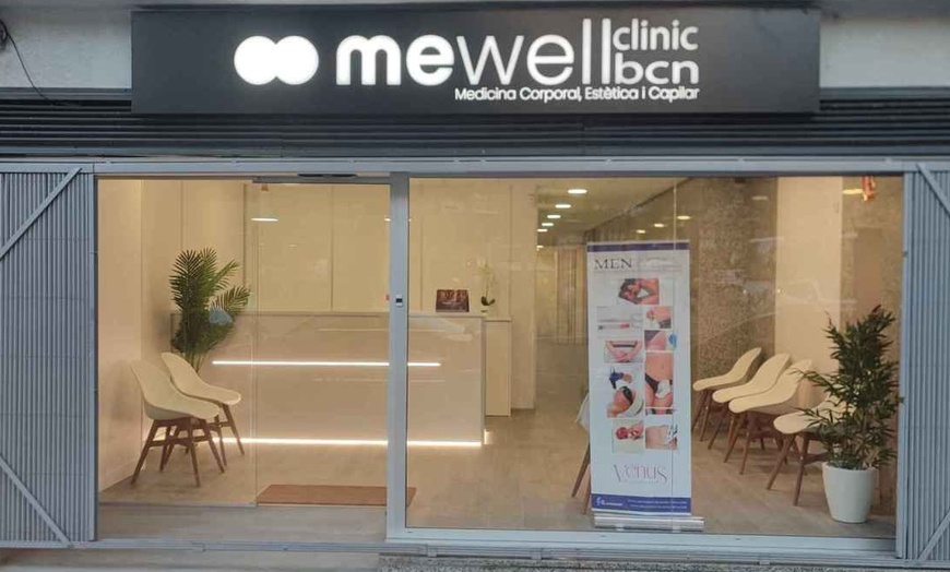 Image 2: 1 o 2 viales de 1 ml de relleno dérmico en zona a elegir