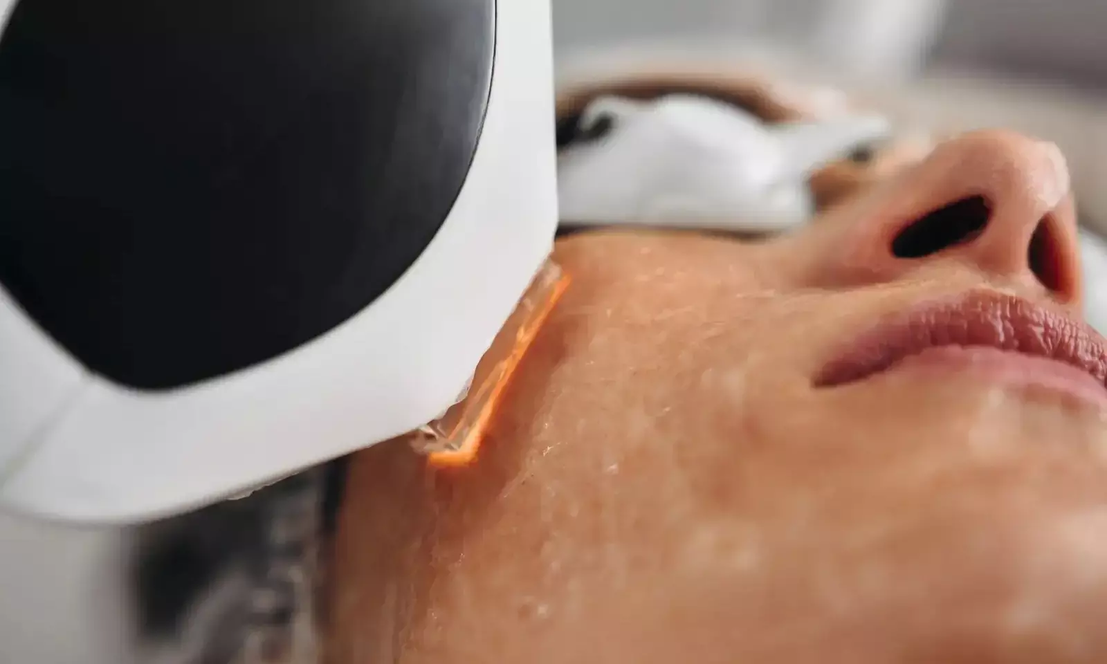 Up to 51% Off on Laser Skin Resurfacing - Branded at Ruaa MedSpa