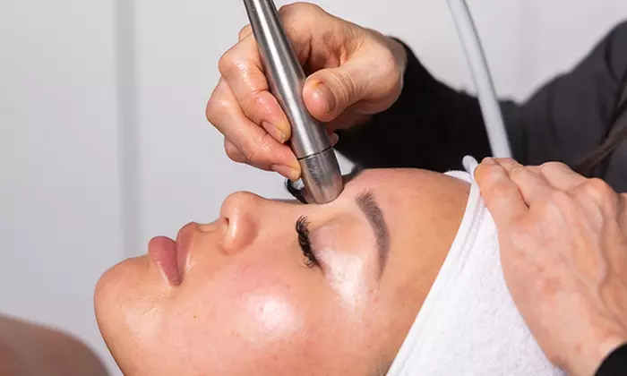 Glycolic Peel or Facial Pamper Package at Carness Hill or Campbelltown