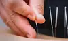 Kathy Gibbons Acupuncture Offers Acupuncture Treatment with Bodywork For Holistic Wellness (Up to 30% Off)