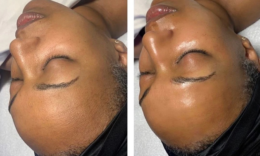 Image 4: One, Two, or Three 60-Minutes Belle Hydra Rejuvenation Sessions