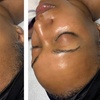 Image 4: One, Two, or Three 60-Minutes Belle Hydra Rejuvenation Sessions