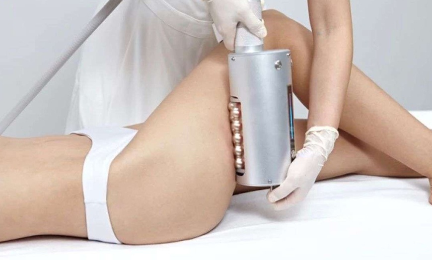 Image 1: 2, 4 o 6 sesiones de tratamiento anticelulítico y reductor RollerWaver
