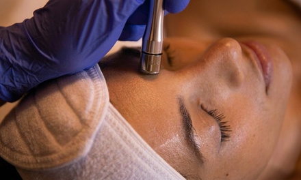 One Advanced Microneedling Facial (60 Minutes) - Golden Glow Aesthetics by Tori