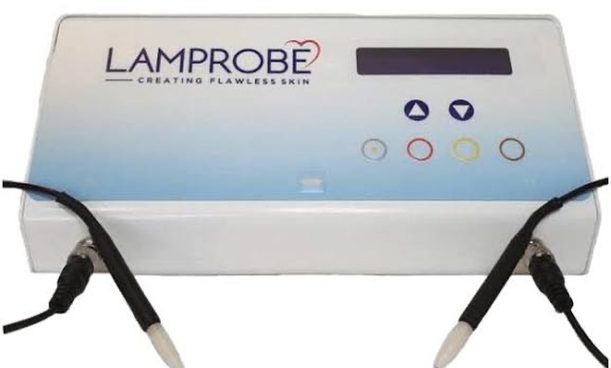 Image 7: One or Two Mole or Skin Tag Removal for Smooth Clear Skin