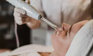 Diversos tratamientos faciales especializados en Estética Carla Saura hasta un 65% de descuento
