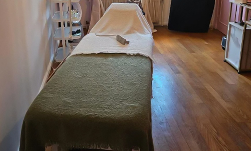 Image 1: Microneedling et peeling d'1h