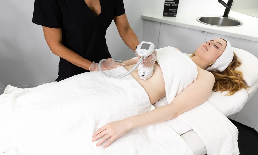 Image 2: 7D HIFU Non-Surgical Skin Tightening & Body Sculpting - Choice of Face or Body Area