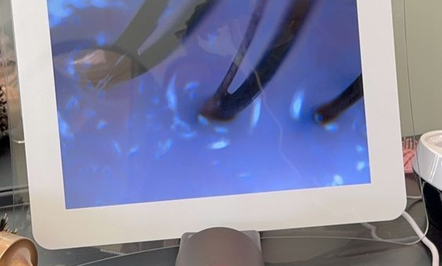 Image 11: Couples & Single Head Spa with Neck/Shoulder Massages, Scalp Analysis