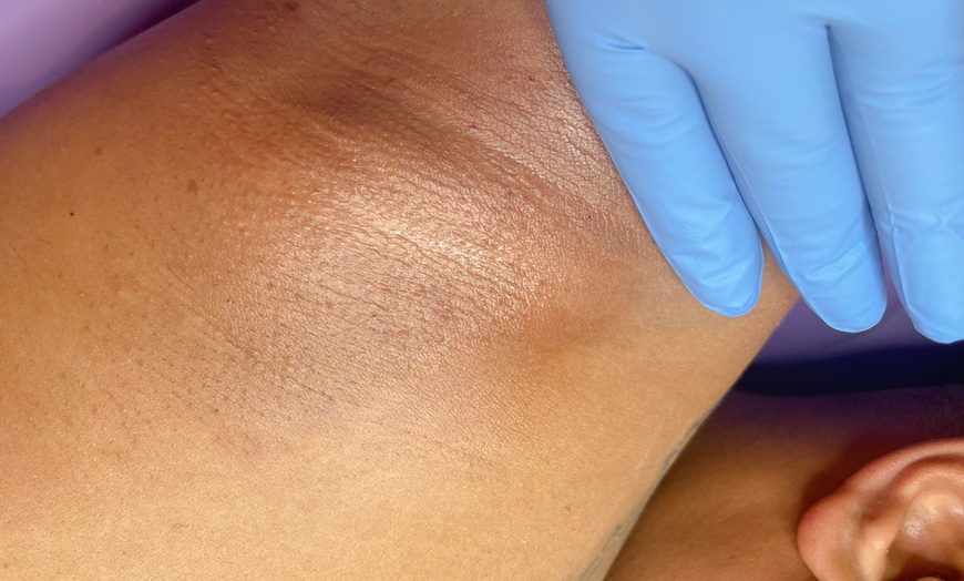 Image 1: Achieve Smooth Underarms with Expert Waxing Services