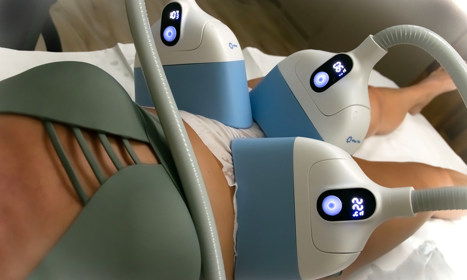 Cryolipolyse à La Teste : silhouette affinée avec 4 aspirations