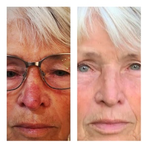 50 € Wertgutschein anrechenbar auf eine Behandlung ab 200€ - Cleaness Behandlungszentrum