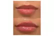 One Syringe of Juvederm Ultra or Juvederm Ultra Plus at Spa Bella Medispa (Up to 43% Off) - Second Medium