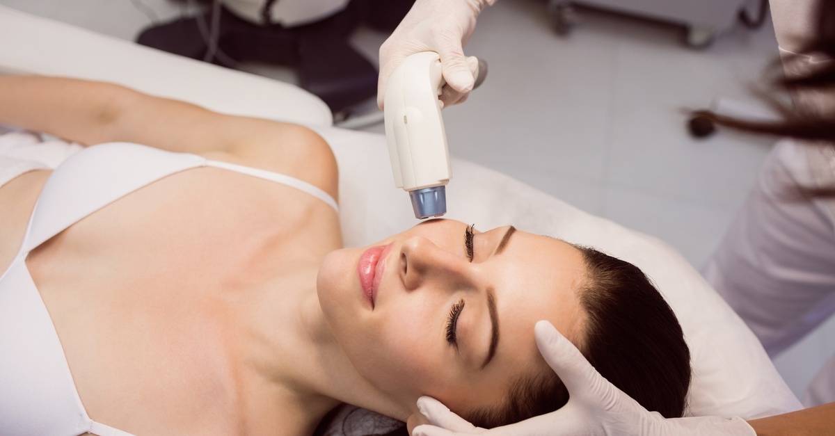 Sesión de radiofrecuencia facial con peeling químico en Málaga