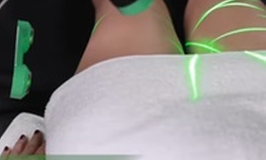 Image 3: Emerald Laser Fat Loss - Up To 4 inches Loss