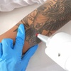 Image 1: 3 o 6 sesiones de eliminación de tatuajes con láser Q-Switched