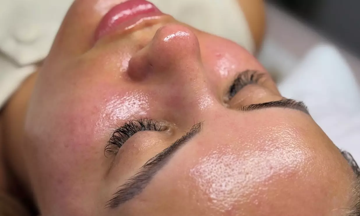 Reveal Radiant Skin With Chemical Peels And Vitamin C Glow Boost