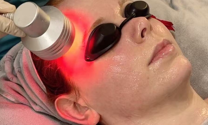 Image 7: Rejuvenating Wellness Packages: Head Spa, HIFU, Ultherapy, IPL & More 