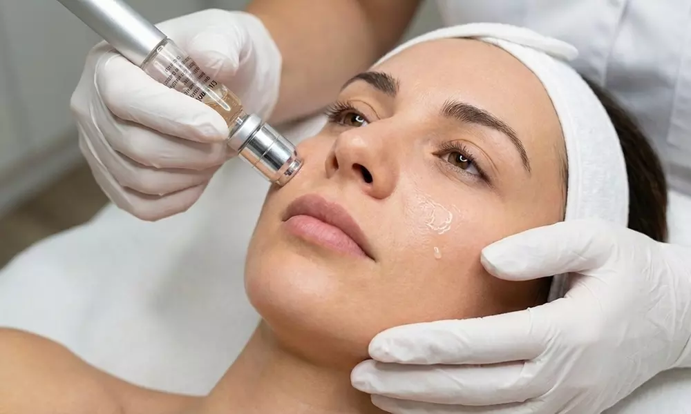1 o 2 sesiones de exosomas con Dermapen en zona a elegir para 1