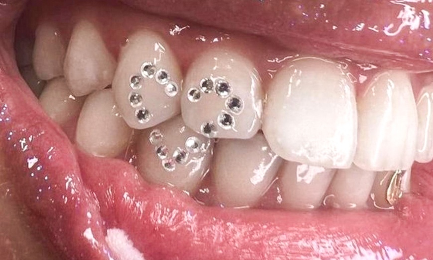 Image 18: Zahnschmuck mit Swarovski®-Kristallen, Lashlifting oder Browlifting