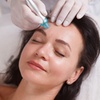 Image 2: Microneedling, klassische oder Luxury-Anti-Aging-Gesichtsbehandlung