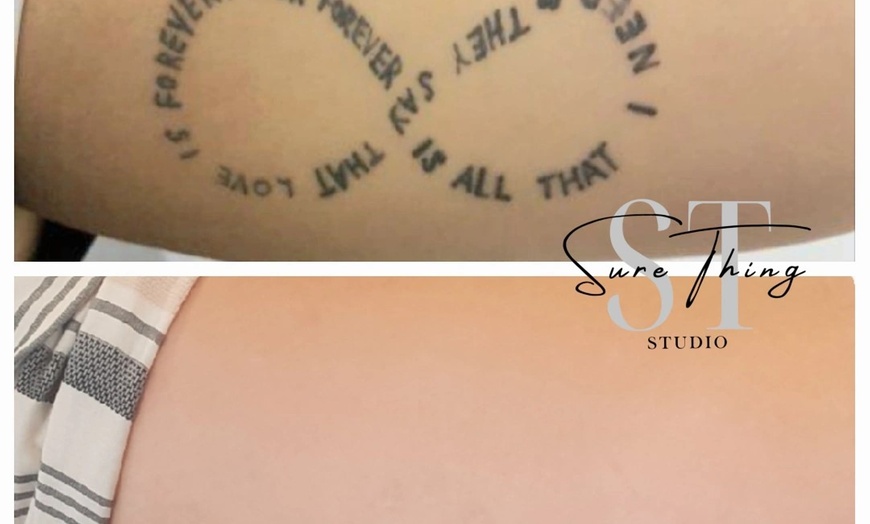 Image 5: Up to 86% Off on Tattoo Removal at Sure Thing Studio