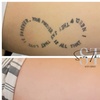 Image 5: Up to 86% Off on Tattoo Removal at Sure Thing Studio