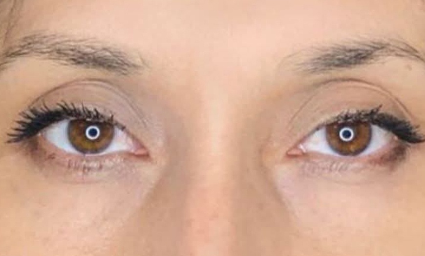 Image 14: Sesión de micropigmentación de labios, ojos, cejas o capilar para 1