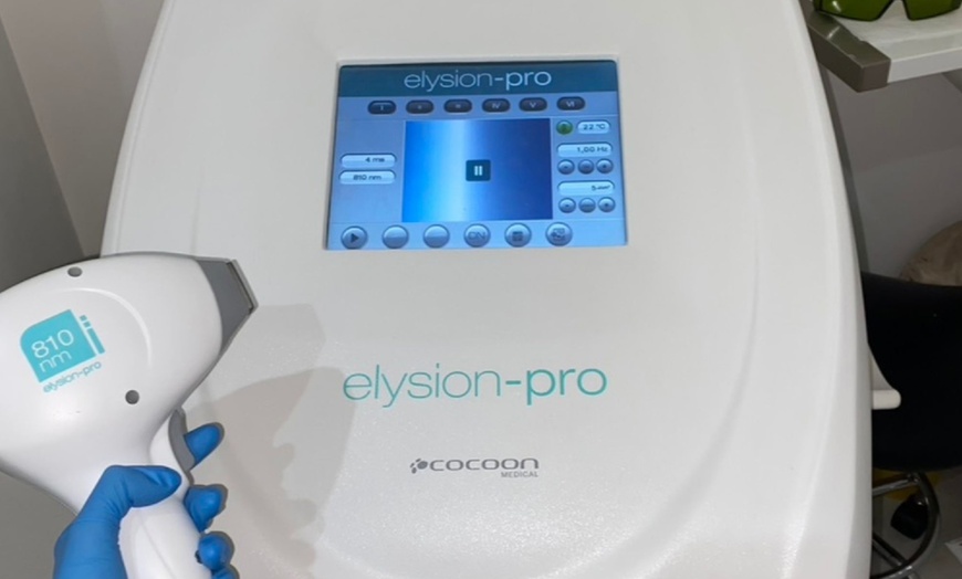 Image 6: Get Smooth Skin: Laser Hair Removal 