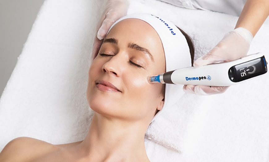 Image 1: Radio Frequency or Dermapen Skin Needling on Face & Neck or More