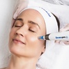 Image 1: Radio Frequency or Dermapen Skin Needling on Face & Neck or More