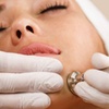 Image 1: Revitalise Your Complexion with Luxury Laser & Skin Facials