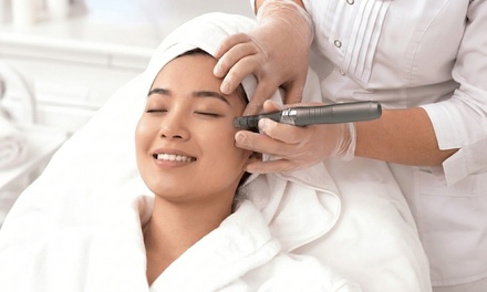 One SessionsRF Skin Tightening + Micron-eedling Facial - Lift, Firm & Glow - Luscious Tox Aesthetics