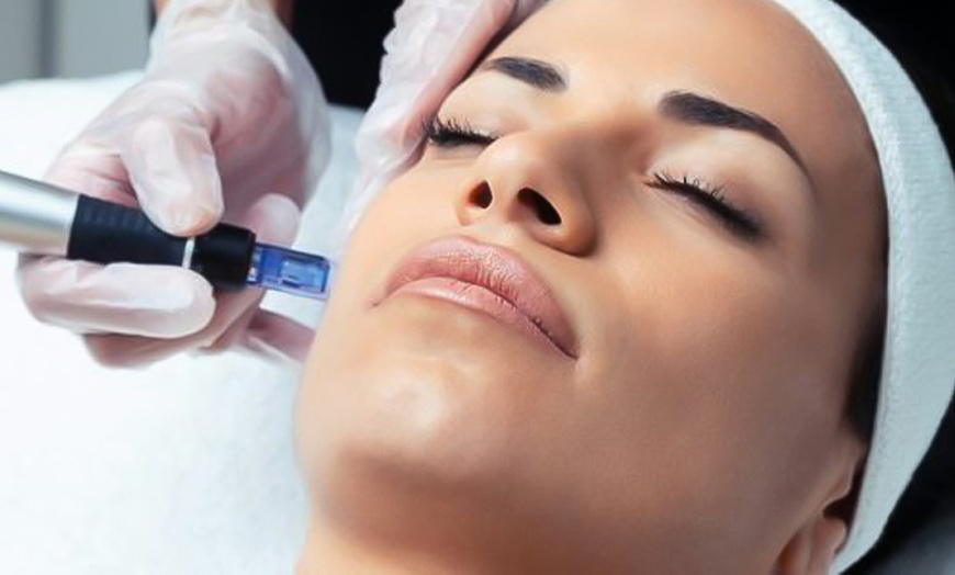 Image 2: Lift & Tighten: HIFU Neck, Half Face, Full Face, Neck, or Body