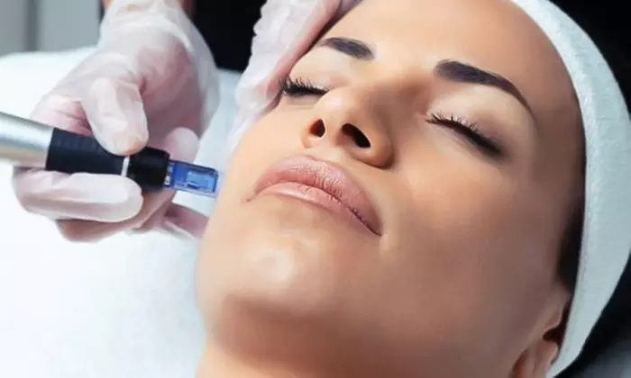 Lift & Tighten: HIFU Neck, Half Face, Full Face, Neck, or Body