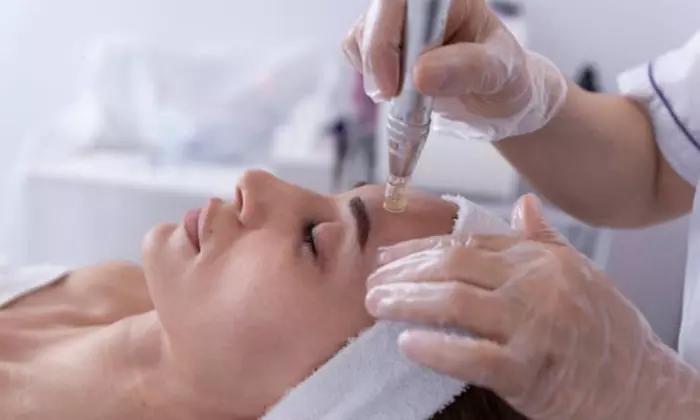 Tratamiento facial con Dermapen, mascarilla y opción a extras para 1
