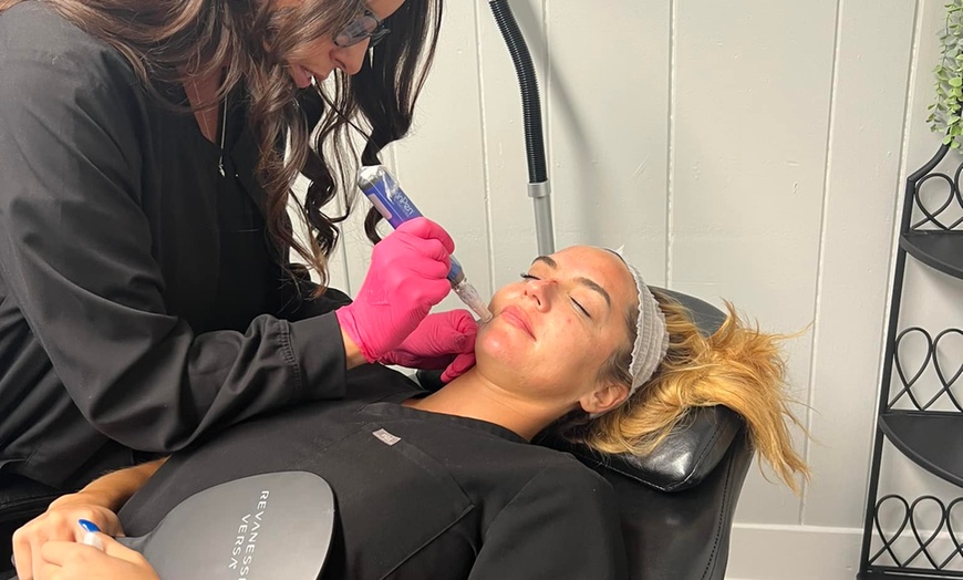 Image 2: Revanesse Versa Dermal Filler for Lips or Under Eyes